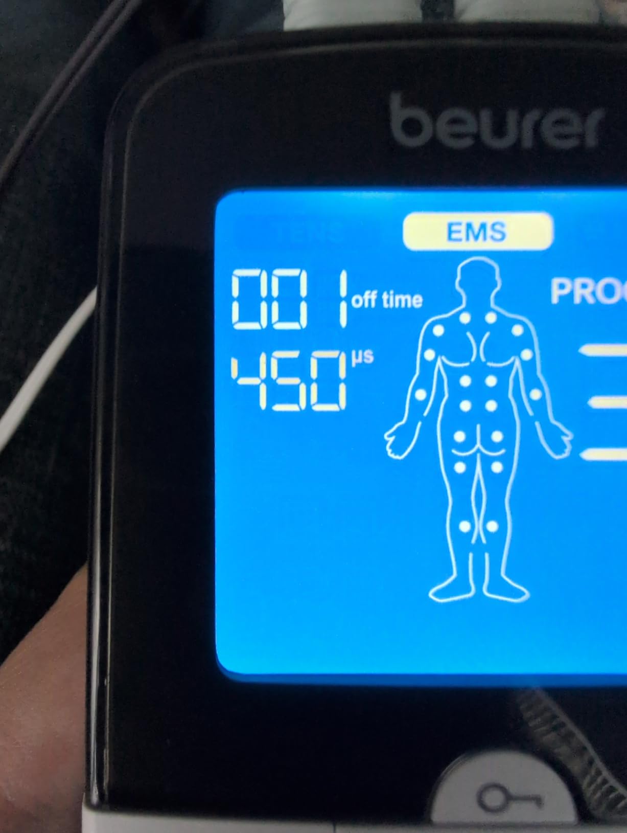 Beurer EM49 Digital TENS & EMS Device for Pain Relief and Muscle Stimulation, 15 TENS Programs, 35 EMS Programs, 2 Adjustable Channels with 4 Self-Adhesive Electrodes customer photo 1