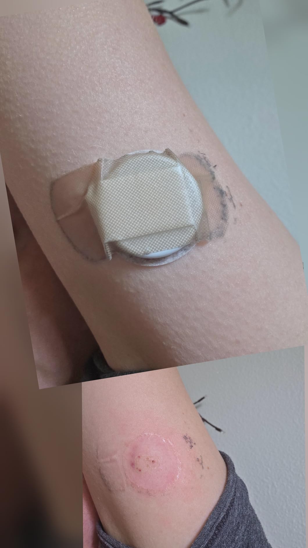 Lingo Continuous Glucose Monitor (CGM) by Abbott - Real-time Glucose Data & Insights, 1 Biosensor Lasts up to 14 Days, iOS & Android customer photo 2