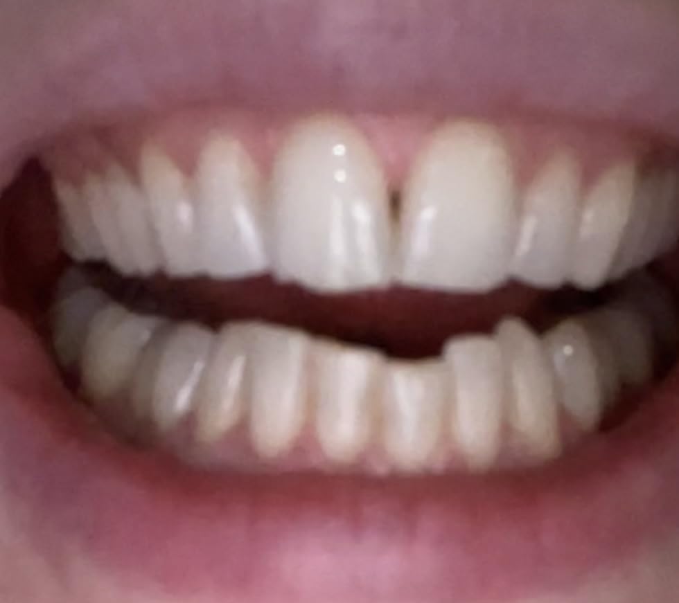 RiseWell Mineral Toothpaste - All Natural Toothpaste with Hydroxyapatite - Made in the USA, Natural SLS-Free Toothpastes - for a Stronger and Healthier Teeth, Wild Mint, 3.4 Oz customer photo 1