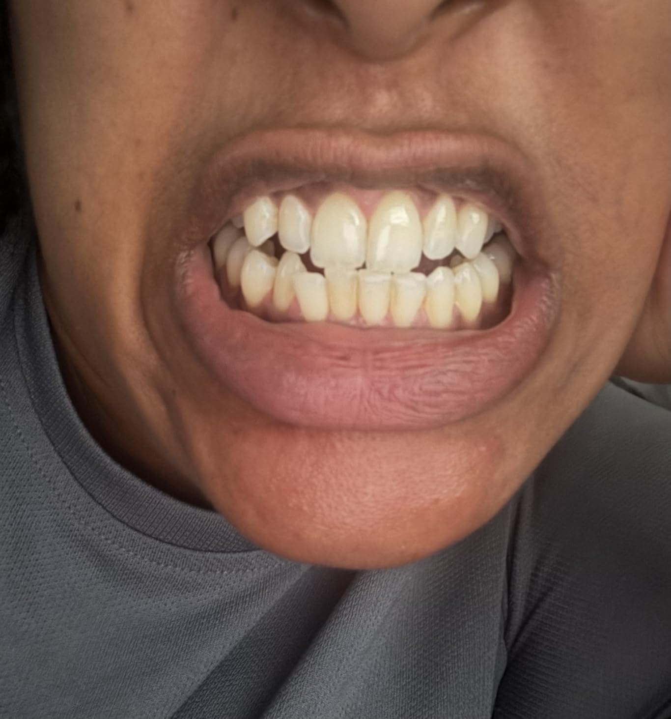RiseWell Mineral Toothpaste - All Natural Toothpaste with Hydroxyapatite - Made in the USA, Natural SLS-Free Toothpastes - for a Stronger and Healthier Teeth, Wild Mint, 3.4 Oz customer photo 2