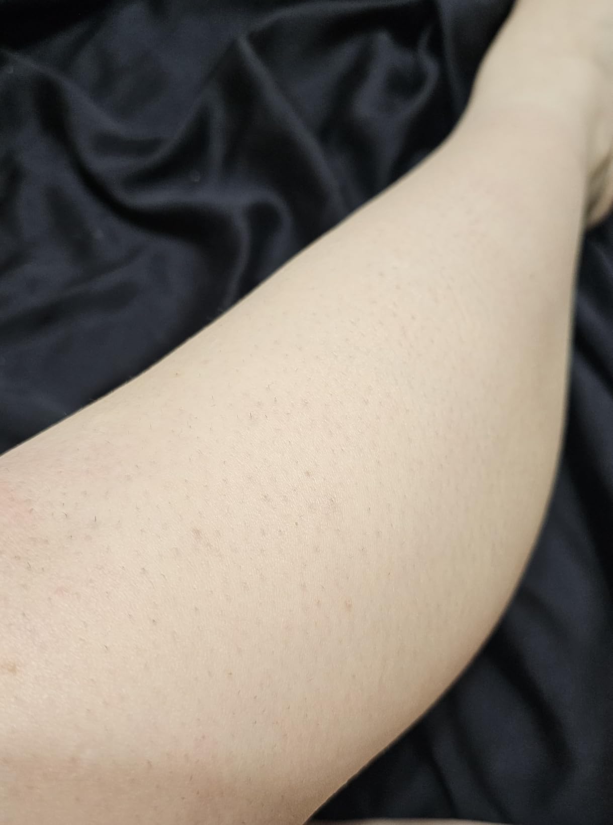 Philips Lumea 9000 Series IPL Hair Removal Device Permanent Laser Hair Reduction for Women & Men, Easy and Comfortable Use at Home, SenseIQ, 4 Attachments for Body, Face, Bikini & Underarms, BRI984/03 customer photo 1
