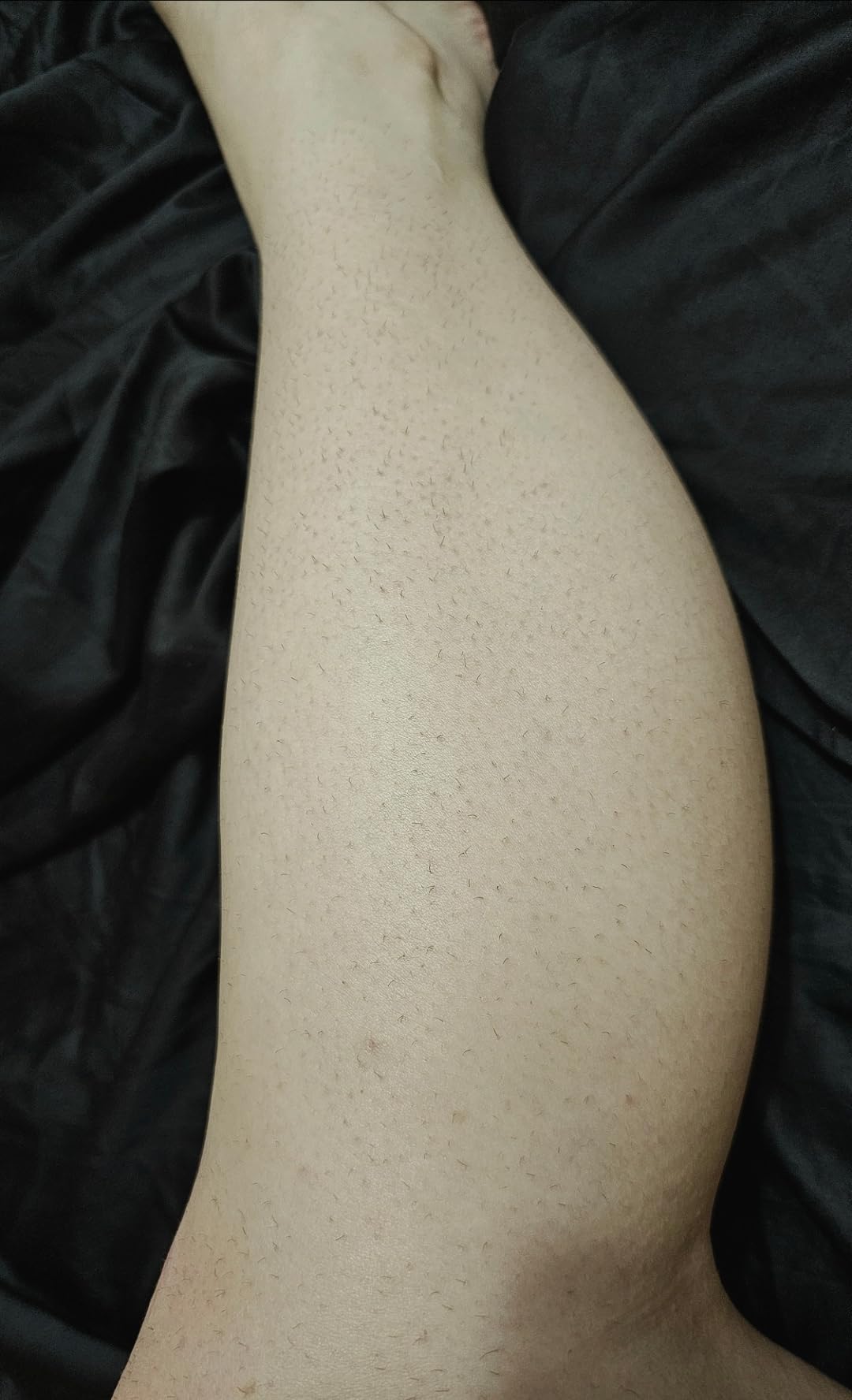 Philips Lumea 9000 Series IPL Hair Removal Device Permanent Laser Hair Reduction for Women & Men, Easy and Comfortable Use at Home, SenseIQ, 4 Attachments for Body, Face, Bikini & Underarms, BRI984/03 customer photo 2