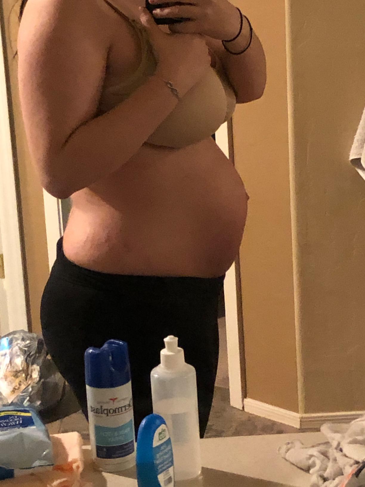 Postpartum Belly Band Support: 2 Adjustable Straps for Abdomen Compression customer photo 1