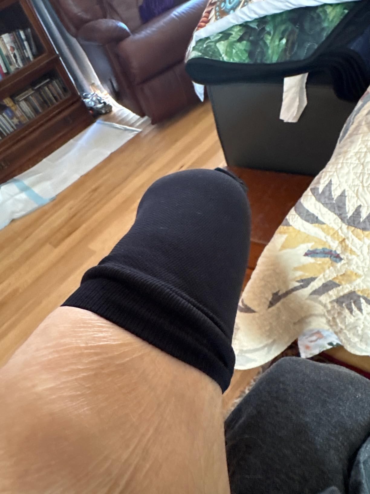 Prosthetic Stump Shrinkers–Below Knee, 40cm, Compression, Amputee Socks, 20-30, Daily use, Taiwan Excellence S customer photo 2