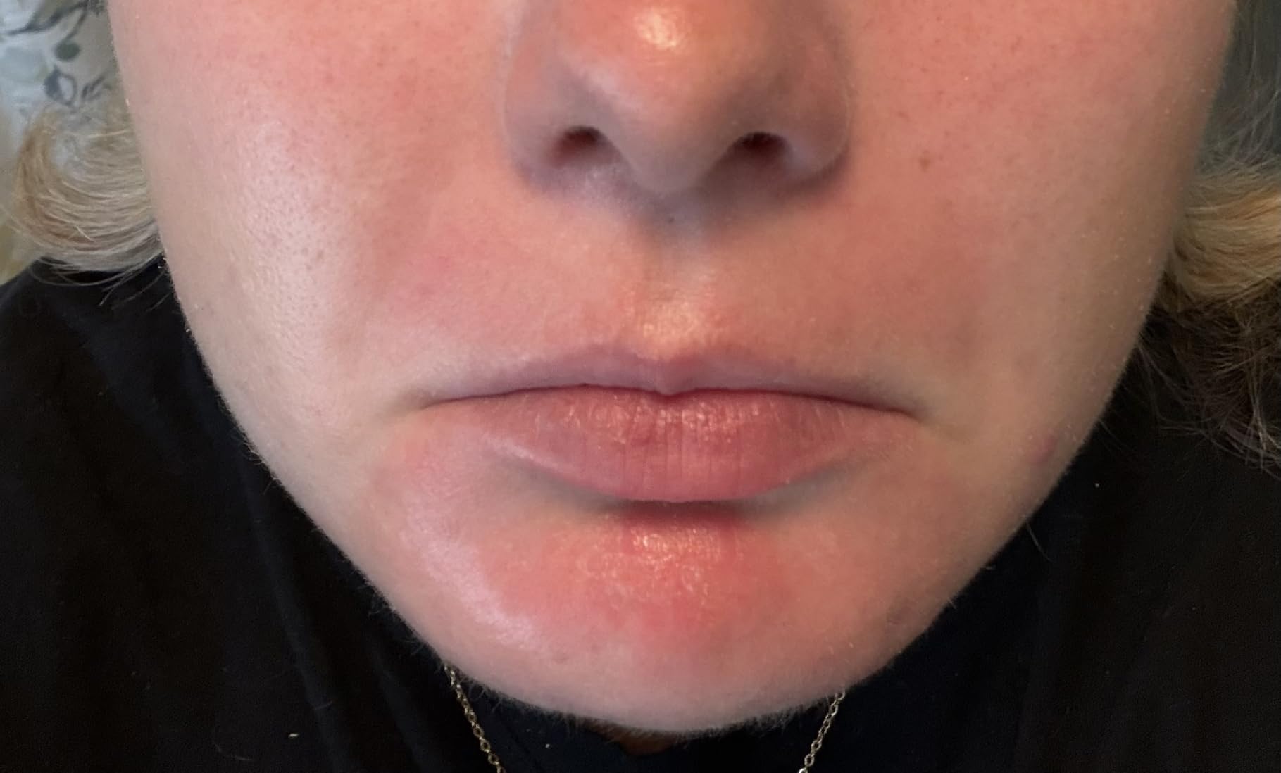 La Roche-Posay Cicaplast Balm B5, Barrier Repair Cream for Dry Skin customer photo 1