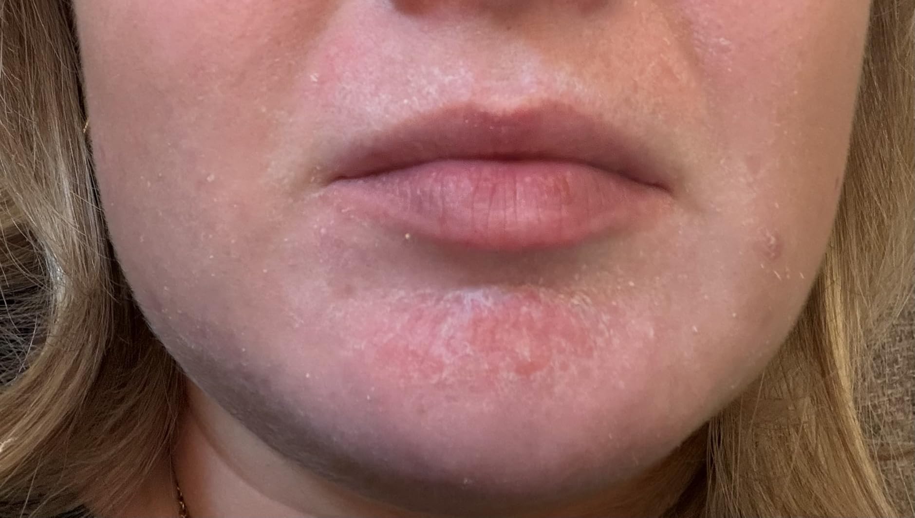 La Roche-Posay Cicaplast Balm B5, Barrier Repair Cream for Dry Skin customer photo 2
