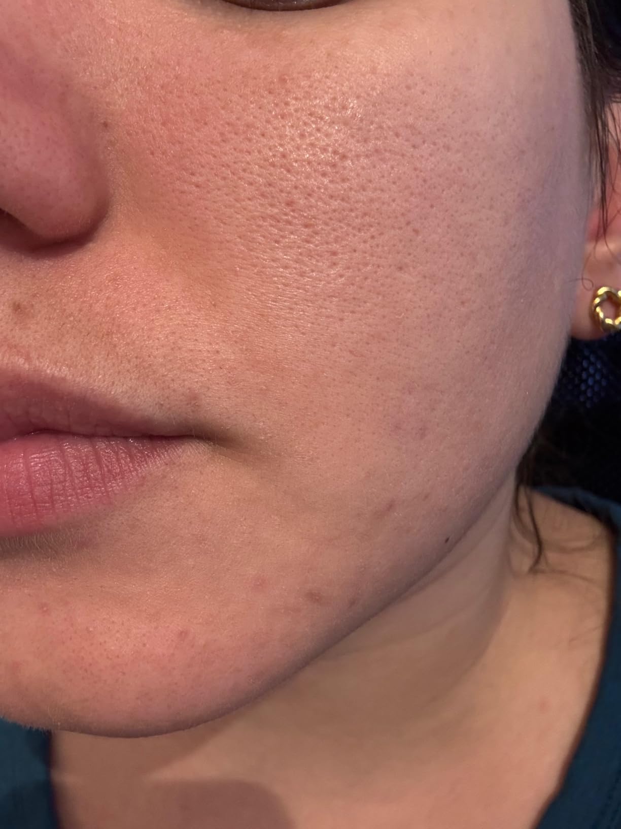La Roche-Posay Effaclar Mat Oil Free Face Moisturizer for Oily Skin customer photo 1