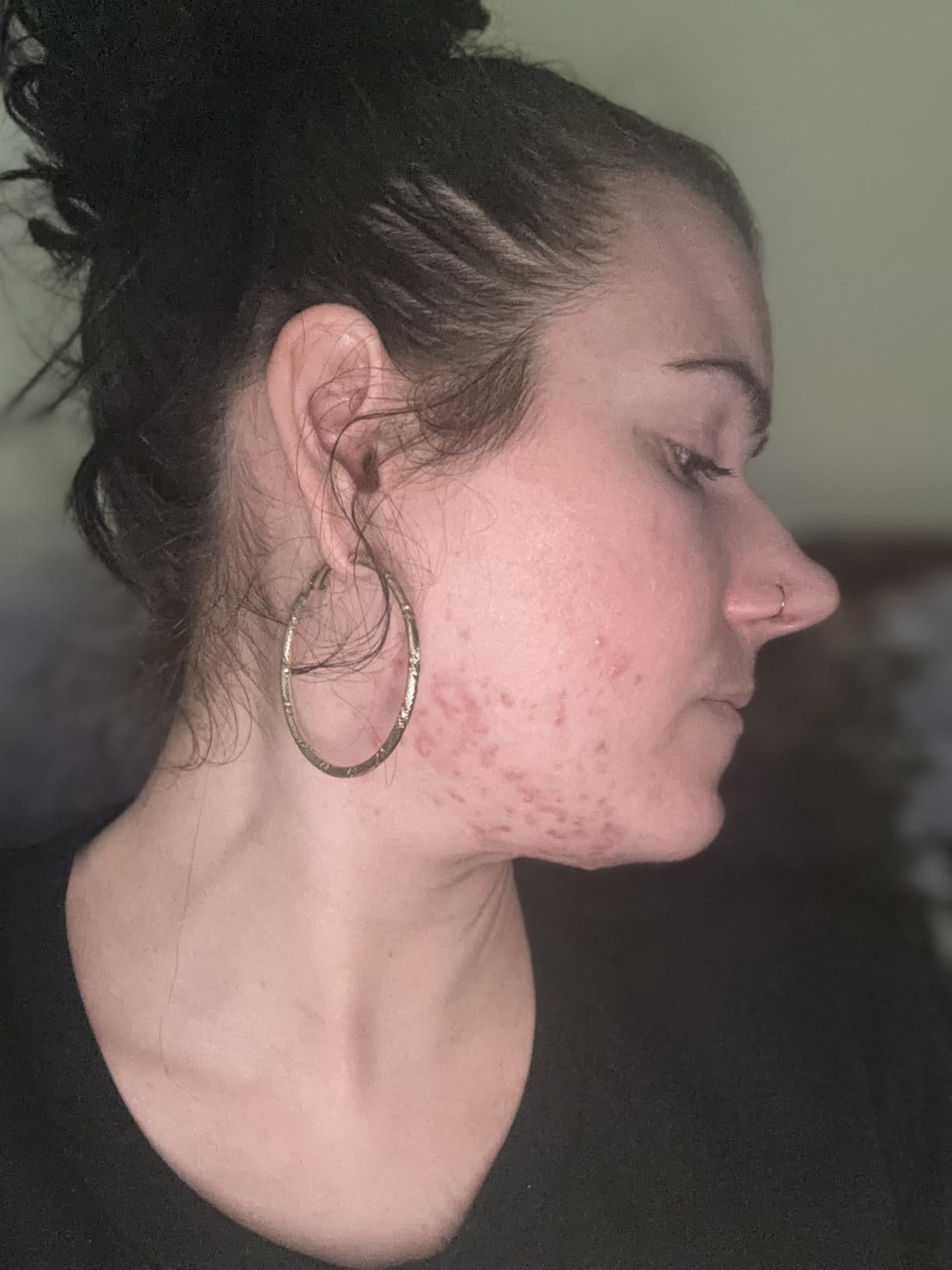 La Roche-Posay Toleriane Purifying Foaming Facial Cleanser with Niacinamide customer photo 2