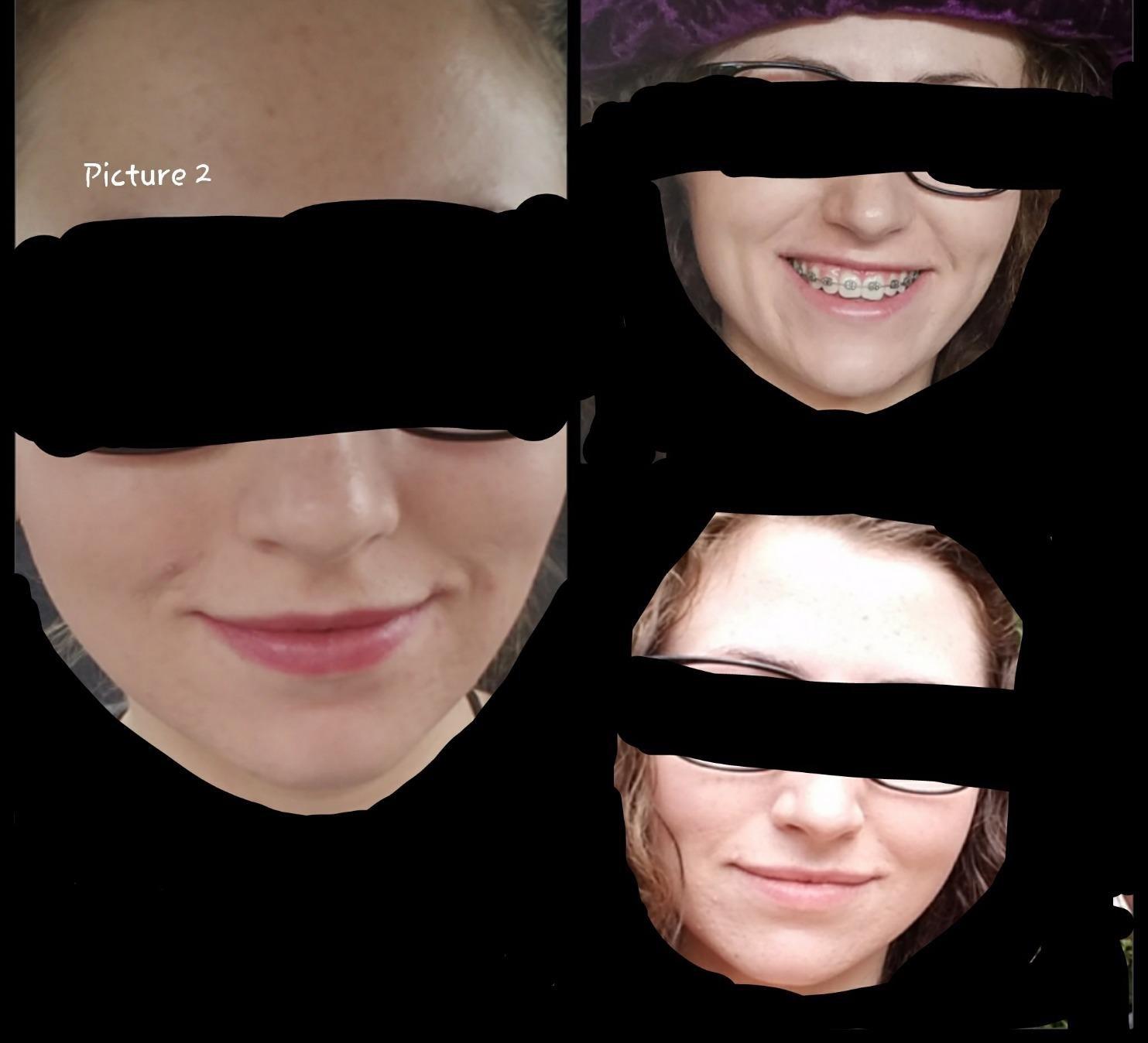 CeraVe Renewing Salicylic Acid Cleanser, Gentle Exfoliating Face Wash, 16oz customer photo 1