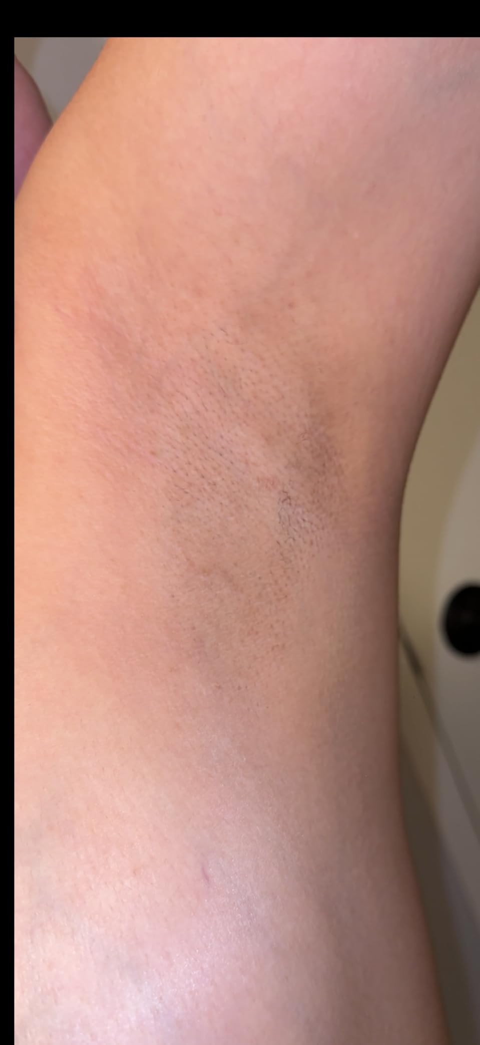 Blex Laser Hair Removal for Women and Men, IPL Hair Removal Device Effective in 2 Weeks, with Ultra-Fast 0.2s Light Emission, Comfortable and Painless, Black customer photo 1